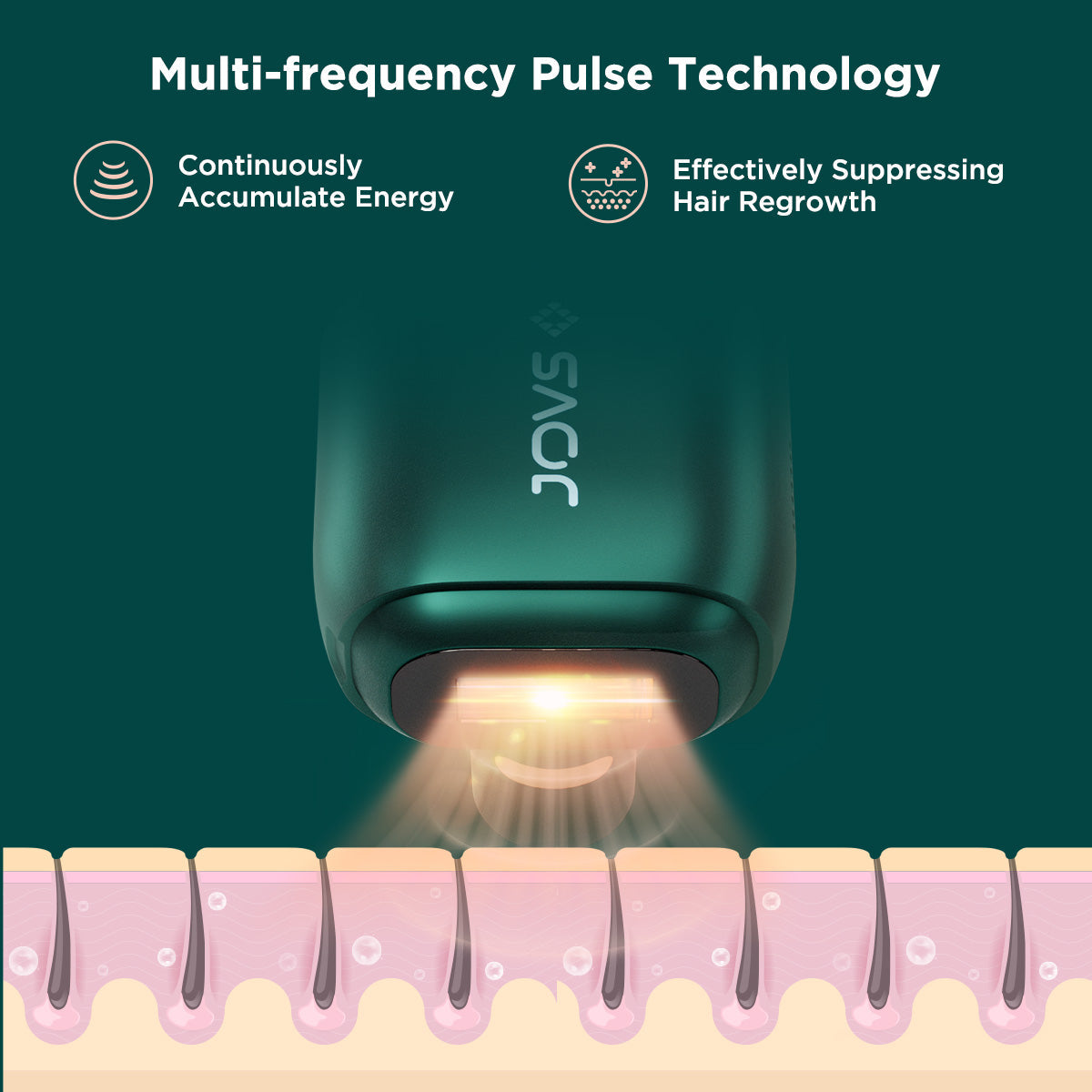 JOVS Venus Pro II IPL Hair Removal Device with Multi-frequency Pulse Technology suppressing hair regrowth.